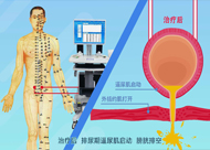 人和醫(yī)院 尿潴留、尿失禁動畫